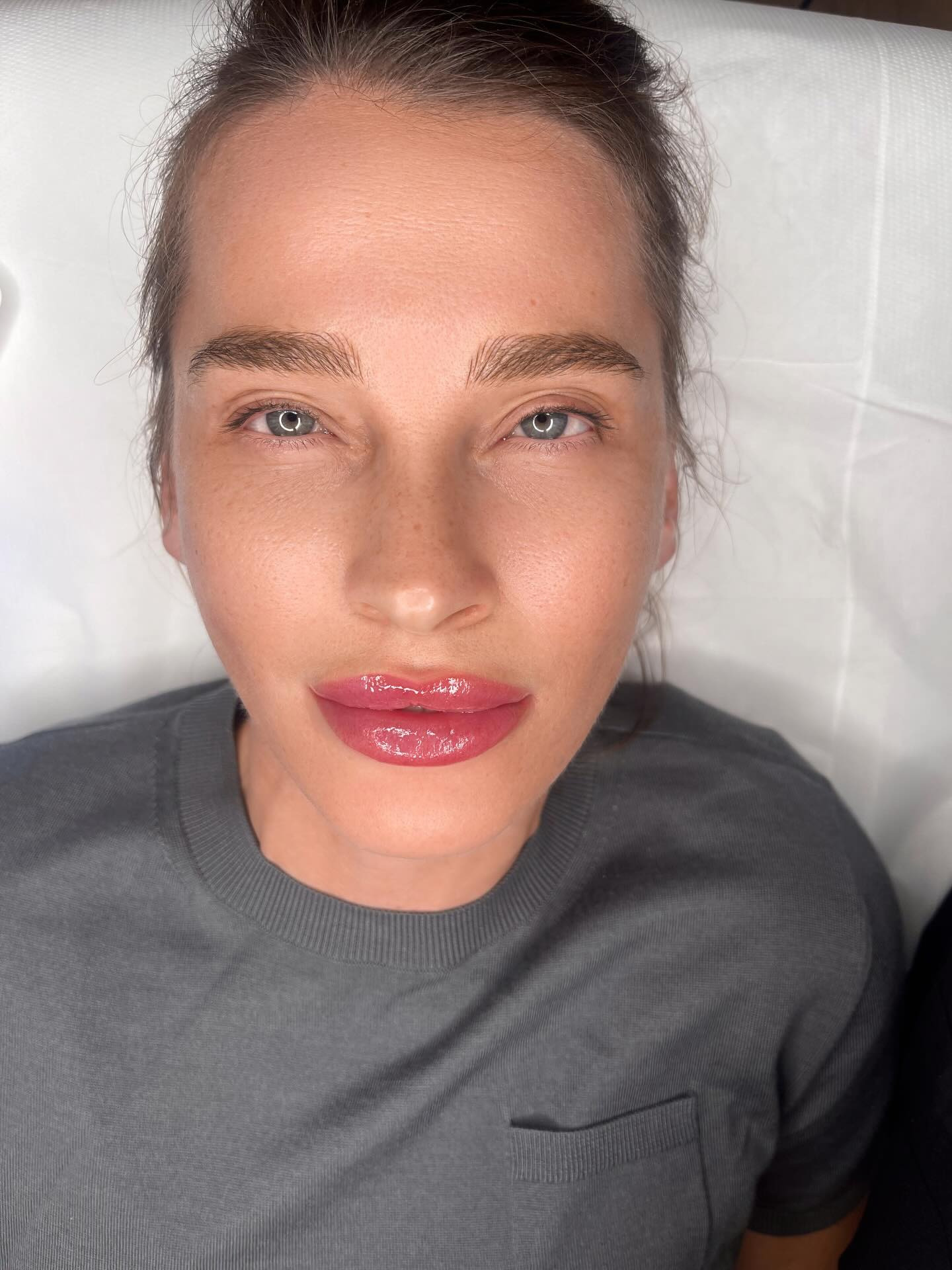 Viso di cliente subito dopo il trattamento Lip Blush